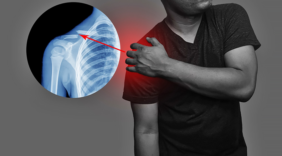 Fracture and Dislocation Treatment